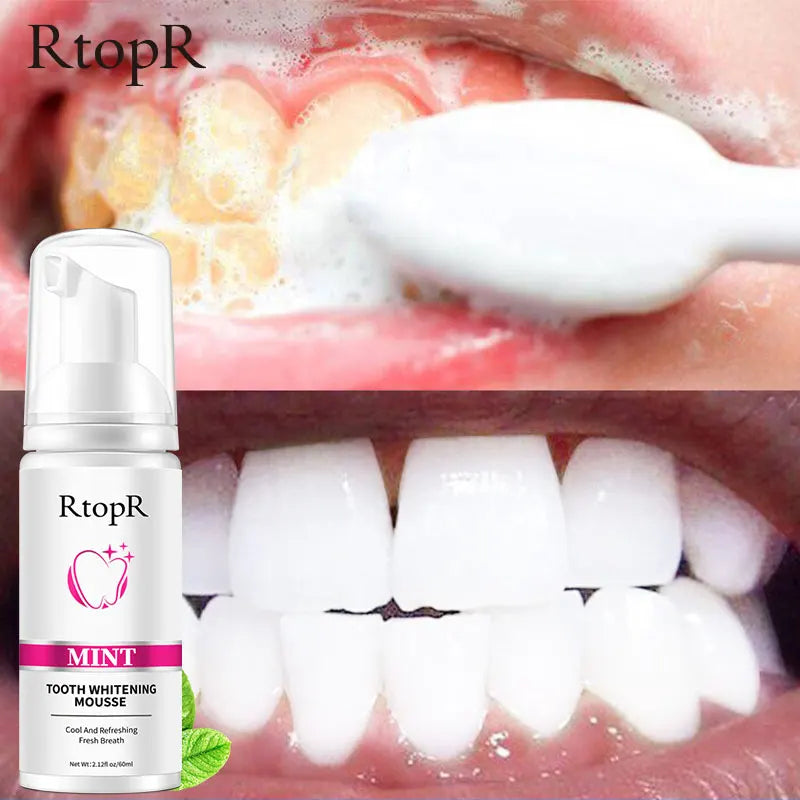 RtopR Teeth Cleansing Whitening Mousse Removes Stains Teeth Whitening Oral Hygiene Mousse Toothpaste Whitening and Staining 60ml