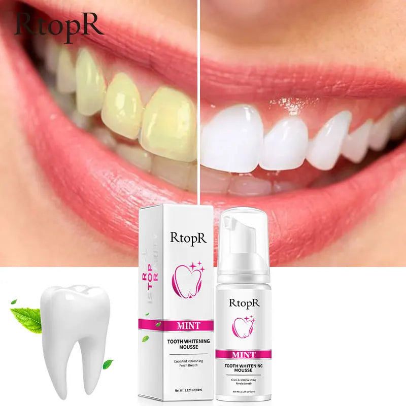 RtopR Teeth Cleansing Whitening Mousse Removes Stains Teeth Whitening Oral Hygiene Mousse Toothpaste Whitening and Staining 60ml