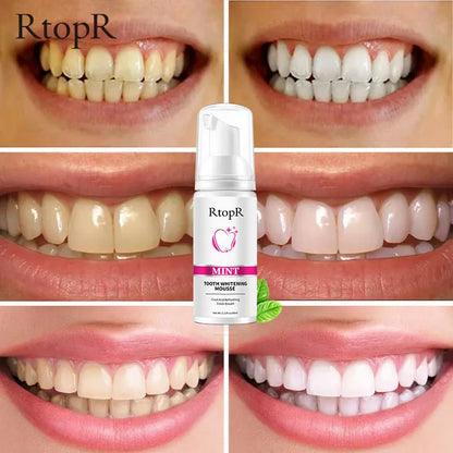 RtopR Teeth Cleansing Whitening Mousse Removes Stains Teeth Whitening Oral Hygiene Mousse Toothpaste Whitening and Staining 60ml